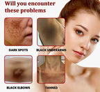Black Spot Repair Cream Brightening & Moisturizing