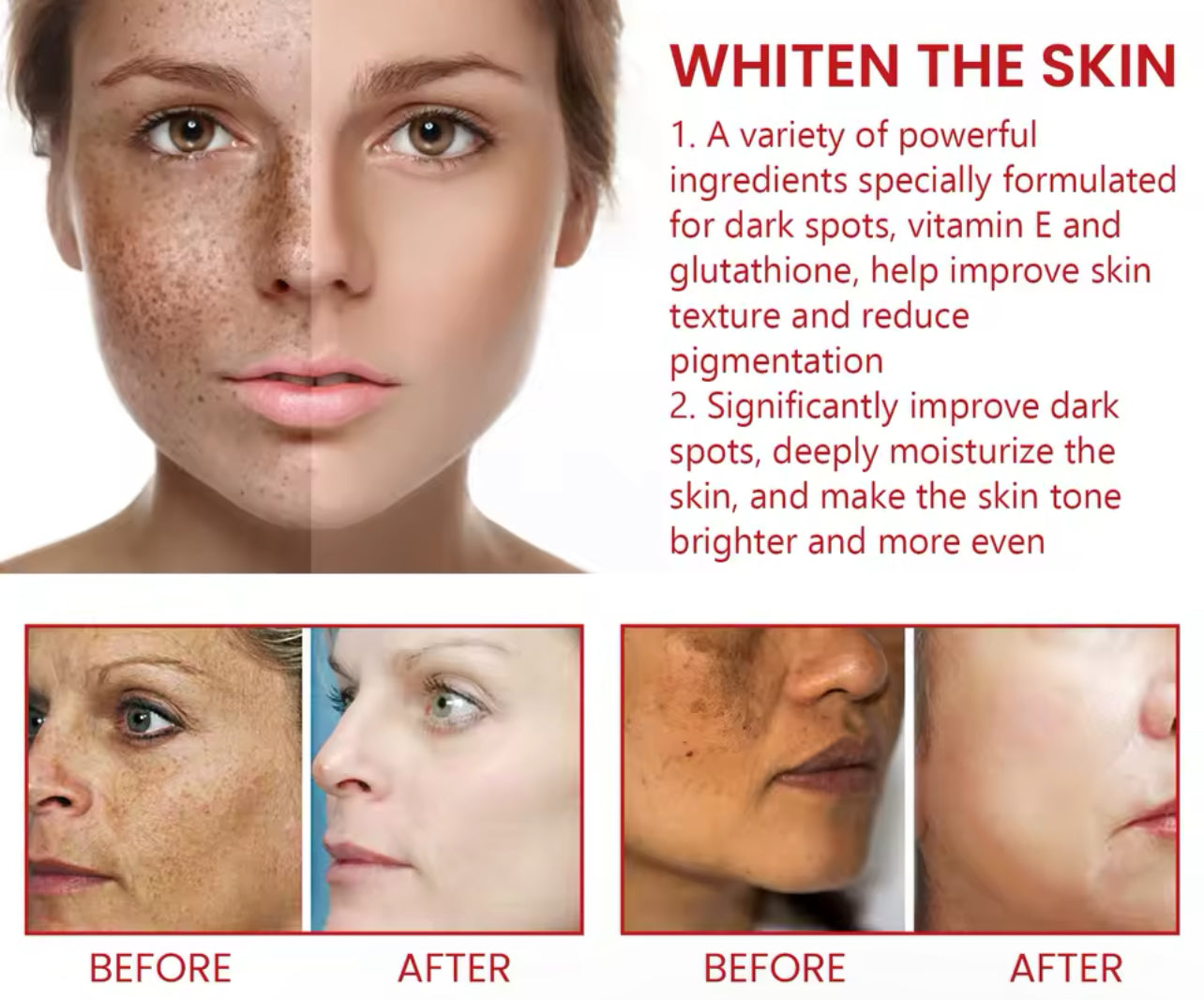 Black Spot Repair Cream Brightening & Moisturizing