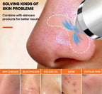 3-in-1 Adjustable Blackhead Removal Vacuum USB Pore Cleaner with Camera