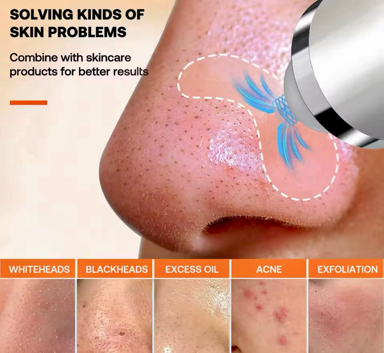 3-in-1 Adjustable Blackhead Removal Vacuum USB Pore Cleaner with Camera