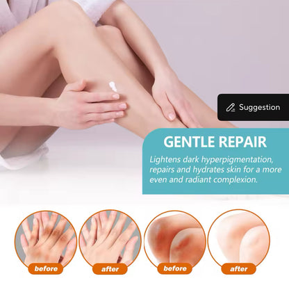 Black Acanthoderma Brightening Repair Cream