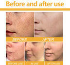 Turmeric & Kojic Acid Brightening Soap Fade Spots & Clear Skin