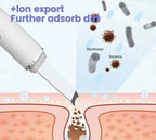 Ultrasonic Facial Skin Scrubber Deep Pore & Blackhead Cleansing Tool