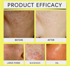 Turmeric Kojic Acid Cleansing Pads 50PCS