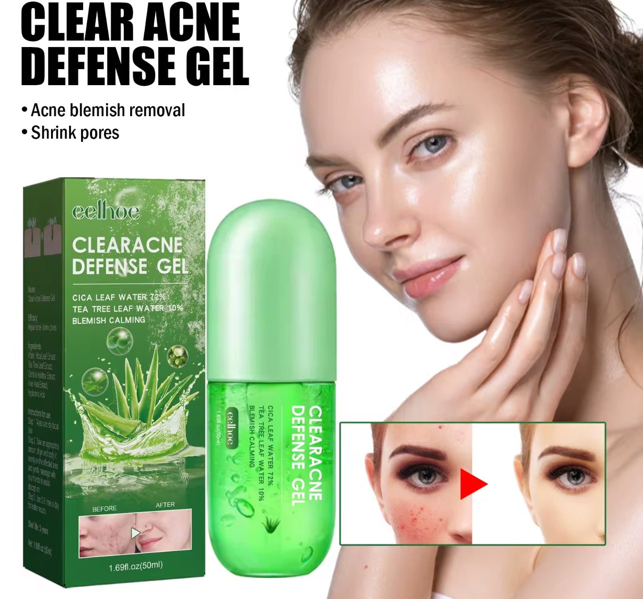 Acne Repair Exfoliating Gel Clears Acne, Refines Pores & Controls Oil