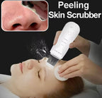 Ultrasonic Skin Scraper Deep Cleaning & Blackhead Remover Facial Spatula