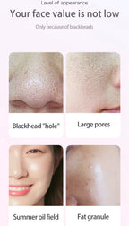 Blackhead Remover with Camera Pore Vacuum Tool with 3 Modes & 6 Heads