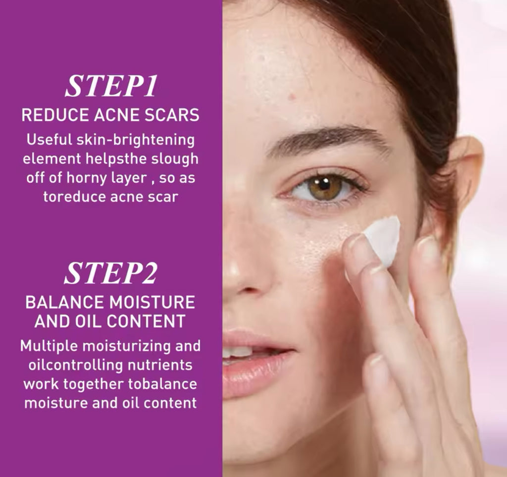 Acne Repair & Oil Control Cream Fights Redness, Shrinks Pores, and Fades Spots