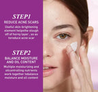 Acne Repair & Oil Control Cream Fights Redness, Shrinks Pores, and Fades Spots