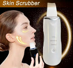 Ultrasonic Skin Scraper Deep Cleaning & Blackhead Remover Facial Spatula