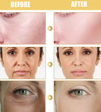 Erfid Yeast Repair Cream Hydrating & Skin Renewal Formula