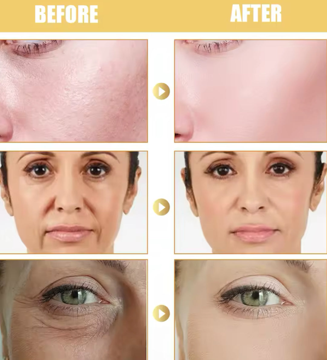Erfid Yeast Repair Cream Hydrating & Skin Renewal Formula