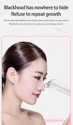 Blackhead Remover with Camera Pore Vacuum Tool with 3 Modes & 6 Heads