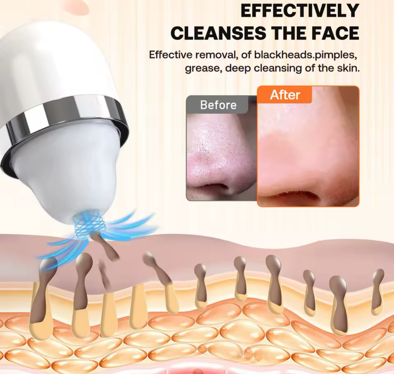 3-in-1 Adjustable Blackhead Removal Vacuum USB Pore Cleaner with Camera