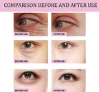 Retinol Eye Cream Stick Dark Circle & Fine Line Reducer