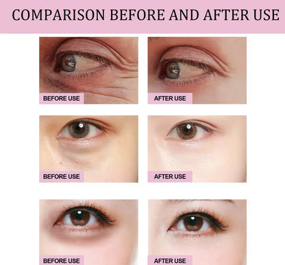Retinol Eye Cream Stick Dark Circle & Fine Line Reducer
