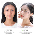 Japan Sakura Peeling Gel – Cherry Blossom Exfoliating Facial Scrub for Deep Cleansing & Smooth Skin