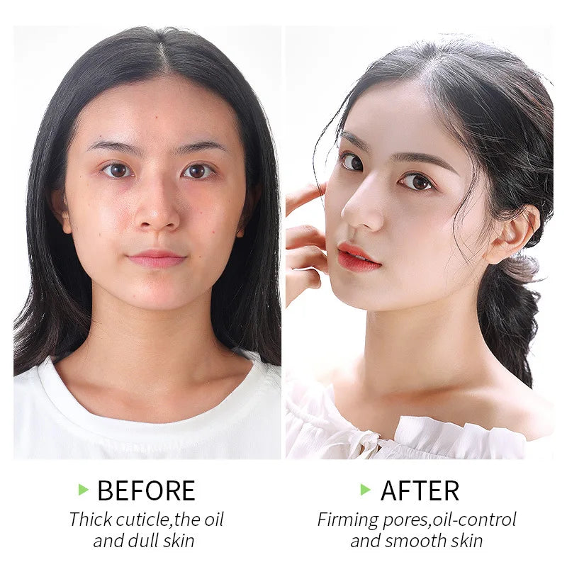 Japan Sakura Peeling Gel – Cherry Blossom Exfoliating Facial Scrub for Deep Cleansing & Smooth Skin