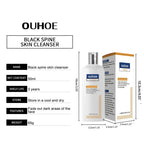 Whitening Facial Cleanser – Fades Dark Spots, Reduces Melasma, Brightens & Smooths Skin, Anti-Acne & Moisturizing Care