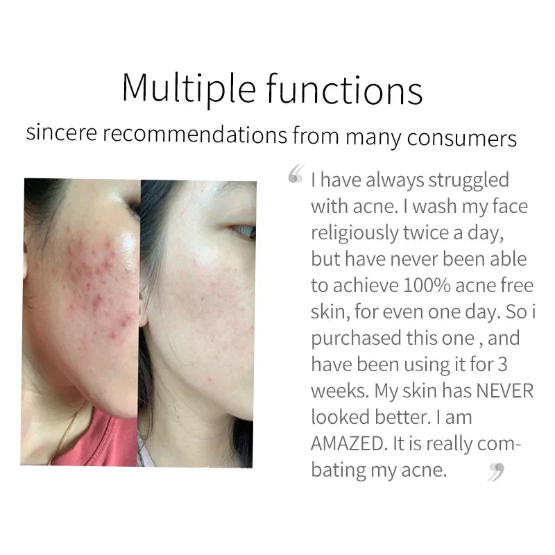 Turmeric Brightening Cleanser – Deep Clean, Acne & Dark Spot Care