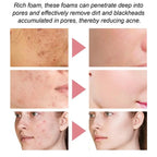 Facial Foaming Cleanser – Deep Clean, Oil Control, Moisturizing, Blackhead Removal