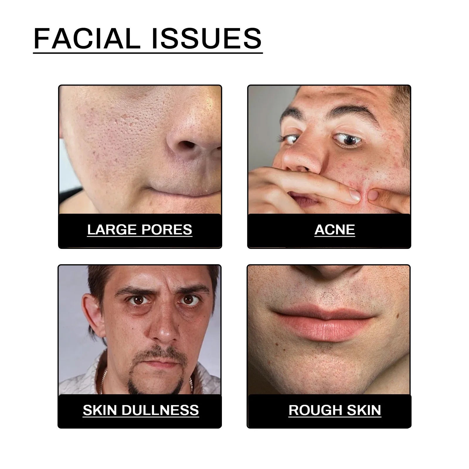 Men’s Facial Cleanser – Acne & Blackhead Control, Oil-Reducing Exfoliating Cream