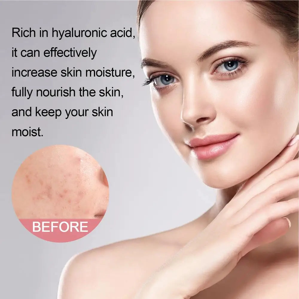 Facial Foaming Cleanser – Deep Clean, Oil Control, Moisturizing, Blackhead Removal