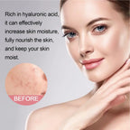 Facial Foaming Cleanser – Deep Clean, Oil Control, Moisturizing, Blackhead Removal