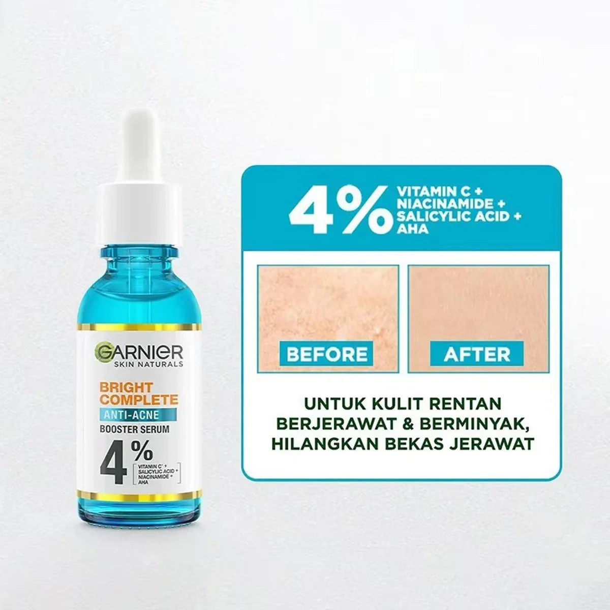 Whitening Repair Essence Serum – 30ml, Pore Minimizing & Brightening