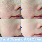 Facial Foam Cleanser – Gentle Pore Cleanser & Oil Control (80g)