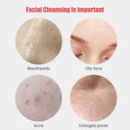 Ultrasonic Silicone Facial Cleansing Brush – Deep Pore & Blackhead Massager