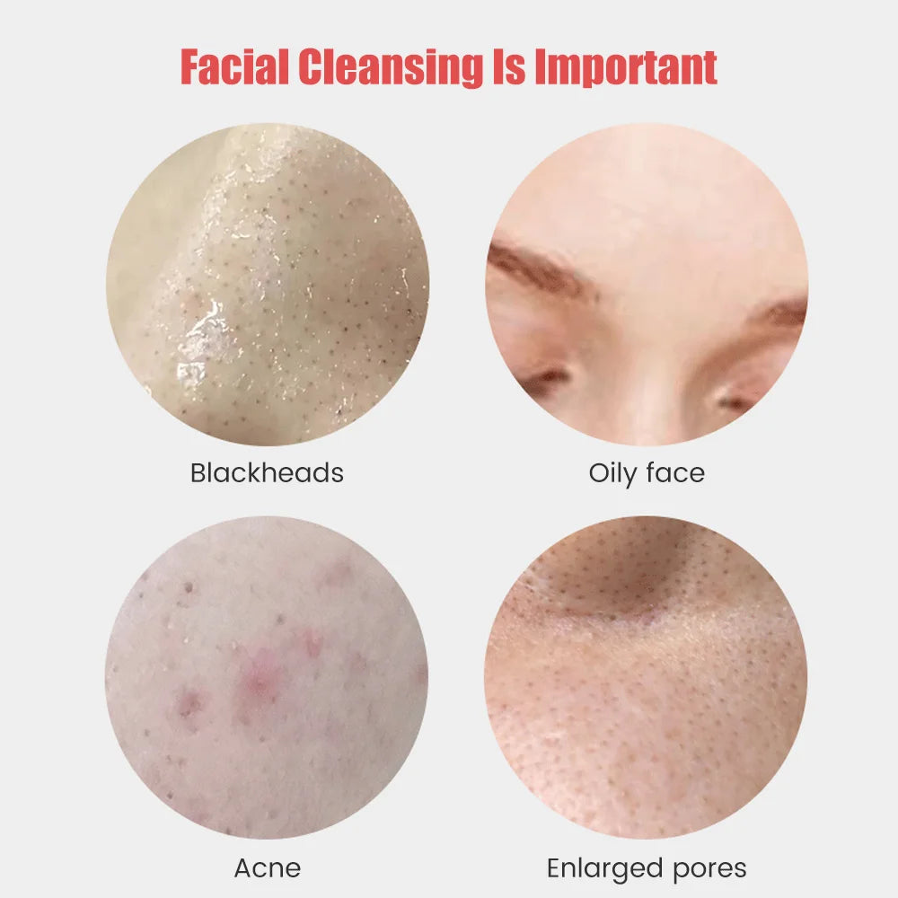 Ultrasonic Silicone Facial Cleansing Brush – Deep Pore & Blackhead Massager