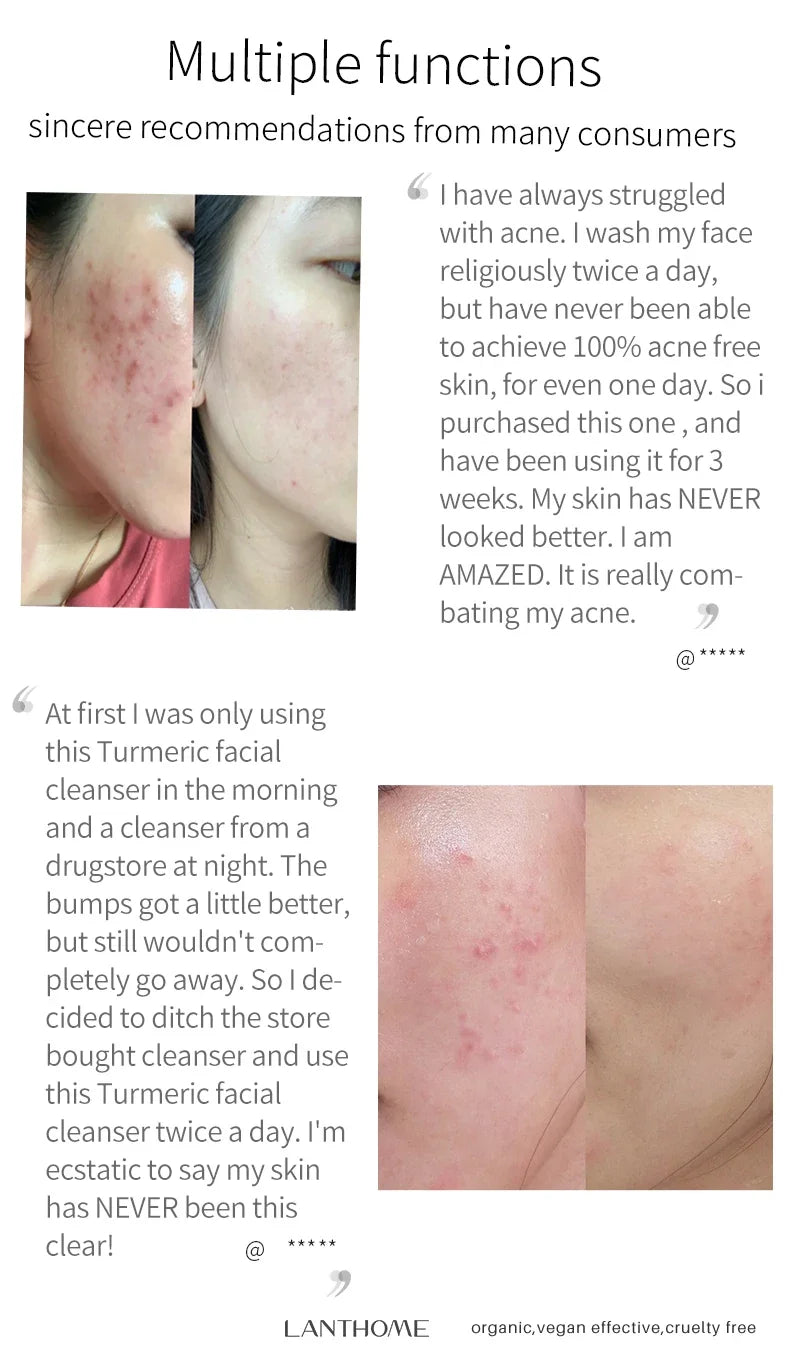 Turmeric Brightening Cleanser – Deep Clean, Acne & Dark Spot Care
