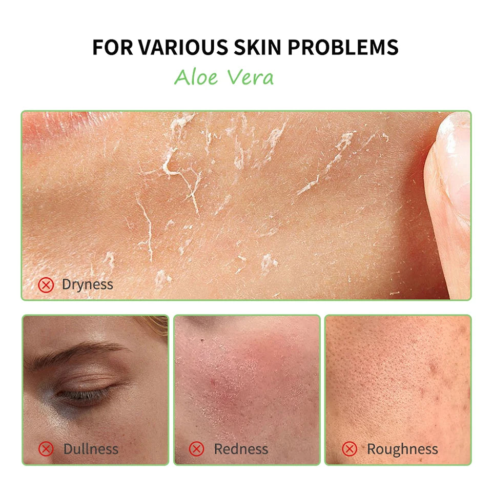 Aloe Vera Skin Care Set – Cleanser, Toner, Serum & Lip Balm (6 pcs) | Deep Hydration & Smooth Skin