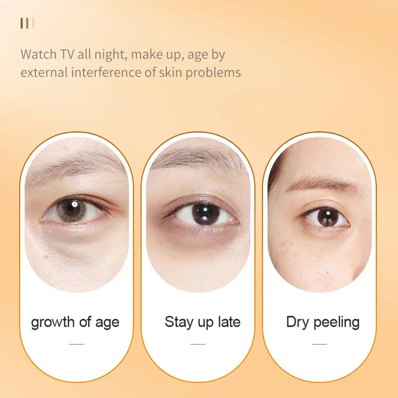 Vitamin C Eye Cream – Anti-Dark Circles, Puffiness & Firming