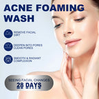 Anti-Acne Oil Control Facial Cleanser – Deep Cleansing, Pore Minimizing, Moisturizing Face Wash (100g)