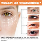 Vitamin C Eye Balm Stick – Brightening, Anti-Puffiness & Dark Circle Treatment