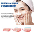 Whitening Facial Cleanser – Fades Dark Spots, Reduces Melasma, Brightens & Smooths Skin, Anti-Acne & Moisturizing Care