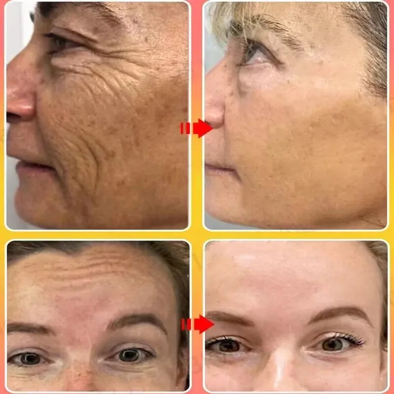 Dragon Blood Anti-Aging Cream – Wrinkle Removal & Firming Facial Serum