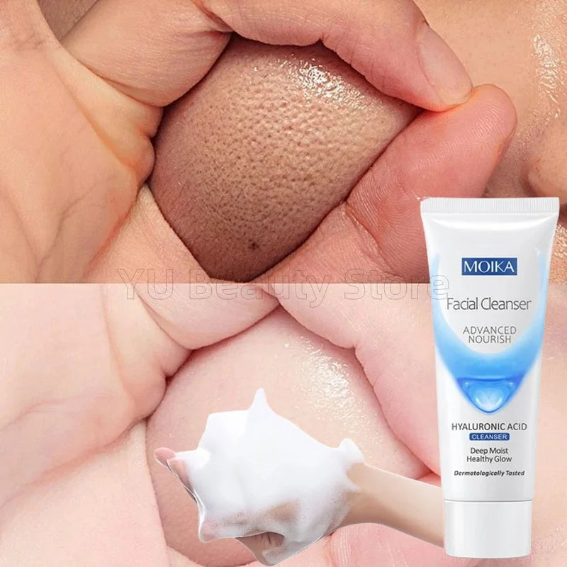 Facial Foam Cleanser – Gentle Pore Cleanser & Oil Control (80g)