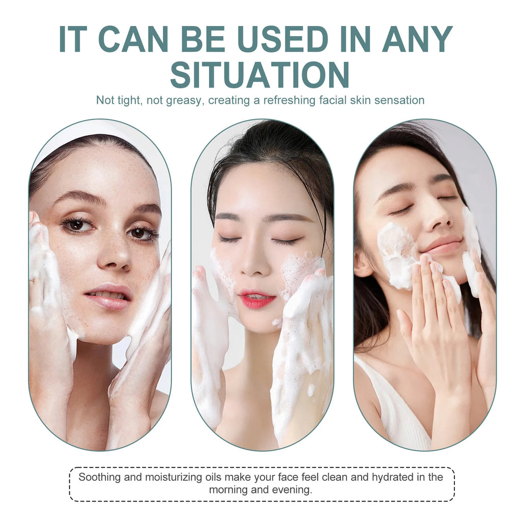 Anti-Acne Oil Control Facial Cleanser – Deep Cleansing, Pore Minimizing, Moisturizing Face Wash (100g)