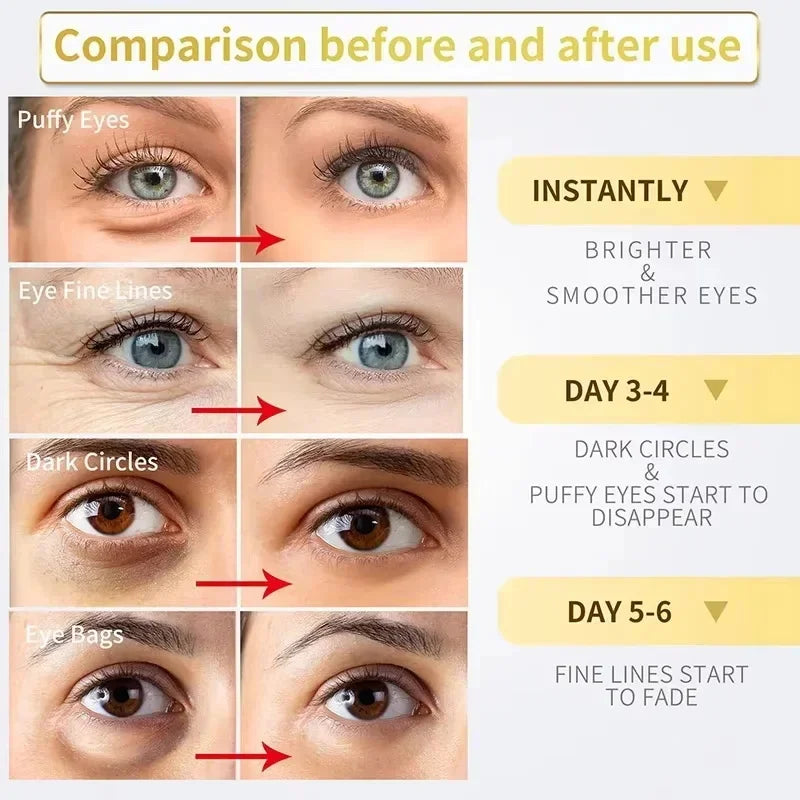Instant Eye Lift Cream – Collagen Anti-Wrinkle & Dark Circle Remover