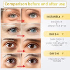 Instant Eye Lift Cream – Collagen Anti-Wrinkle & Dark Circle Remover