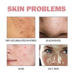 Facial Foaming Cleanser – Deep Clean, Oil Control, Moisturizing, Blackhead Removal