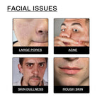 Men’s Facial Cleanser – Acne & Blackhead Control, Oil-Reducing Exfoliating Cream