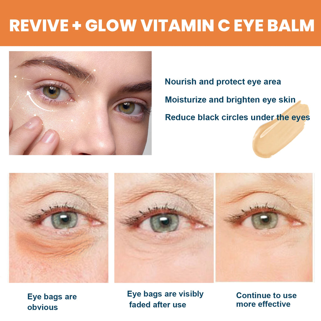 Vitamin C Eye Balm Stick – Brightening, Anti-Puffiness & Dark Circle Treatment