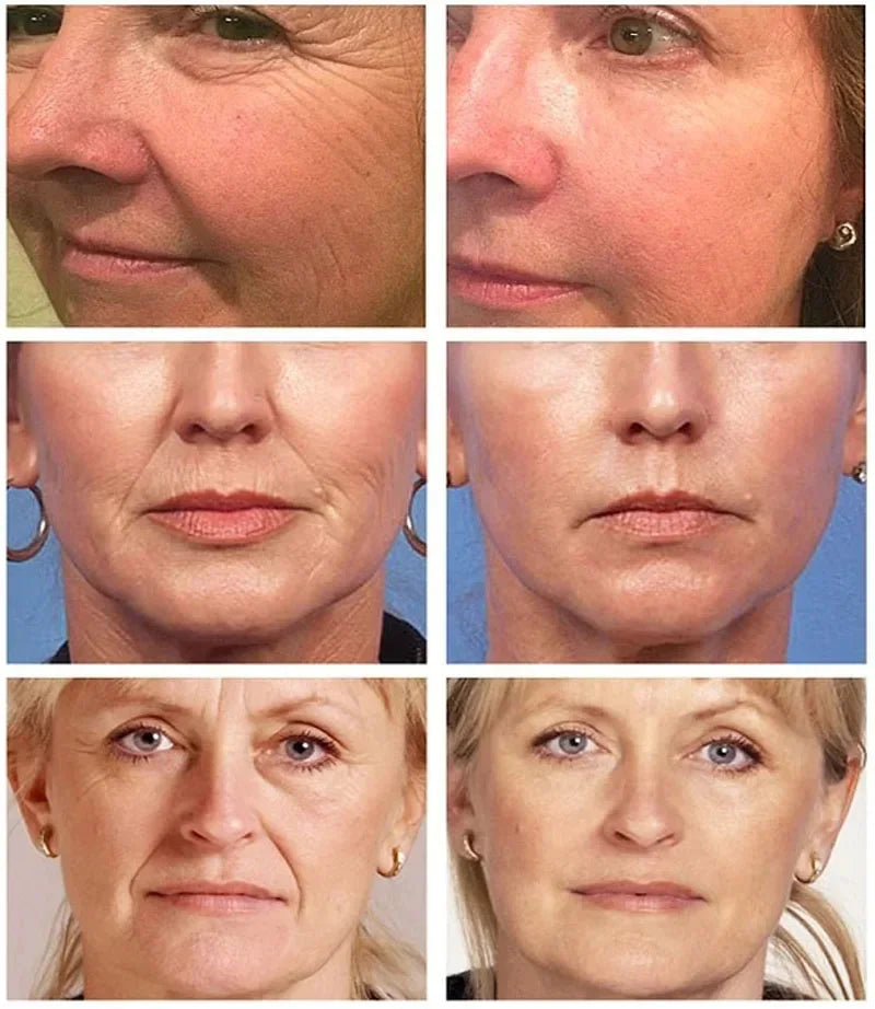 Advanced Anti-Aging Moisturizer | Fine Line Fading, Skin Firming & Brightening Skincare Therapy