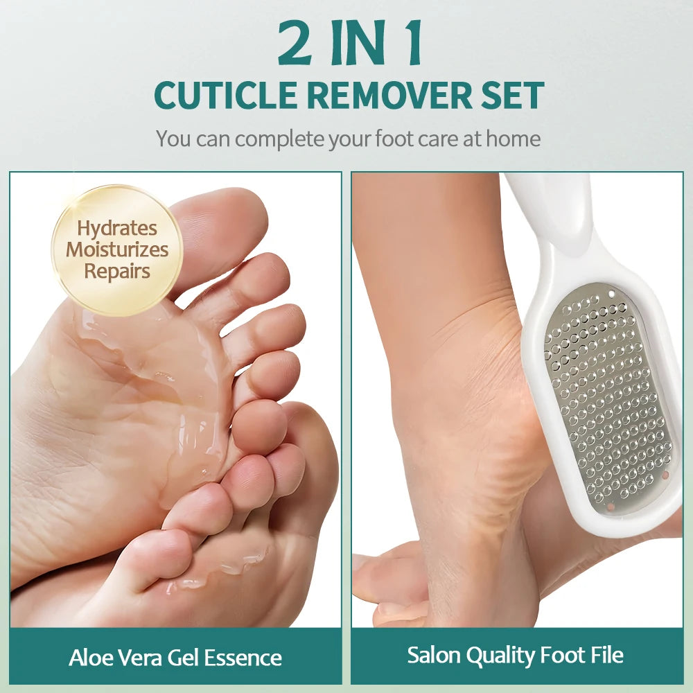 Nailpop Professional Callus Remover Kit – Extra Strength Gel & Foot Rasp File for Cracked Heels & Dead Skin