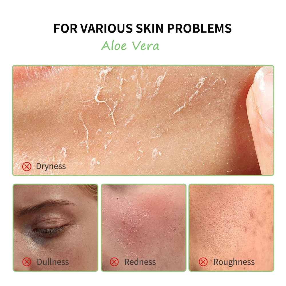 Aloe Vera Skin Care Set – Cleanser, Toner, Serum & Lip Balm (6 pcs) | Deep Hydration & Smooth Skin