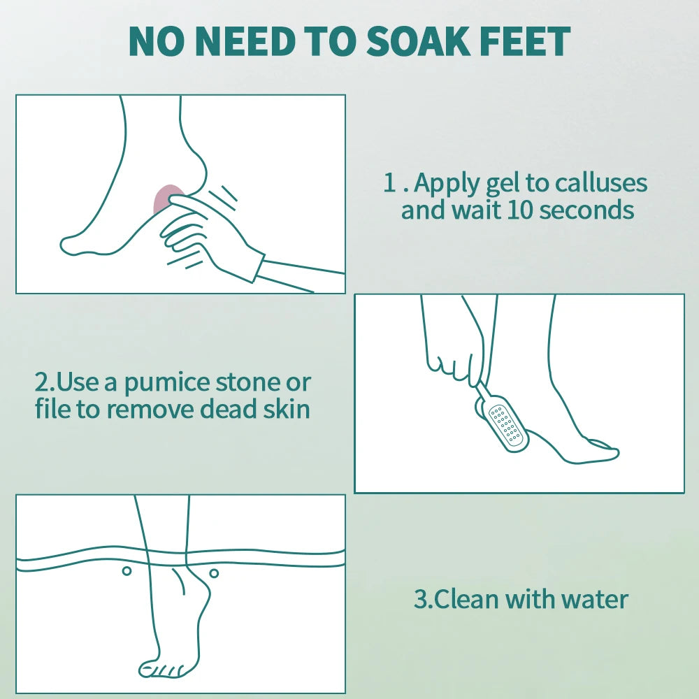 Nailpop Professional Callus Remover Kit – Extra Strength Gel & Foot Rasp File for Cracked Heels & Dead Skin